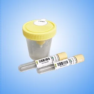 Urine DNA Storage Tube