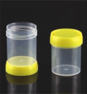 Specimen Container, Yellow Screw Cap