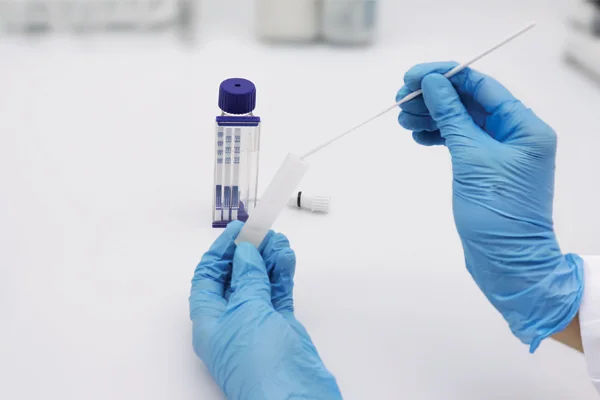 Clostridium difficile GDH + Toxin A + B photo 1